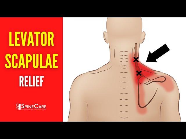 How to Fix Levator Scapulae Pain FOR GOOD