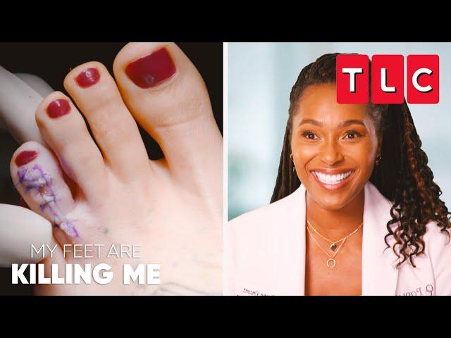 Dr. Vincent’s Most Incredible Moments | My Feet Are Killing Me | TLC