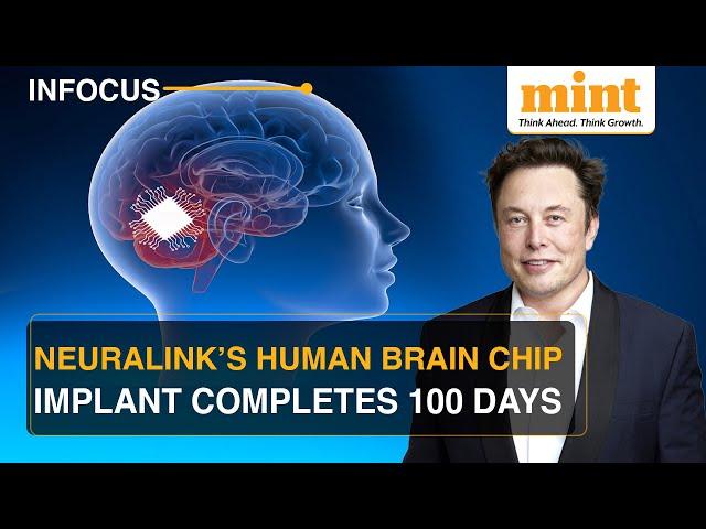 Neuralink: First Brain Chip Implant Completes 100 Days; Musk Hails The Achievement | Watch