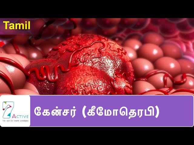 புற்றுநோய் ( கீமோதெரபி ) | Cancer (Chemotherapy) | Tamil