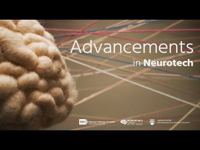 Advancements in Neurotech for Kids with Epilepsy