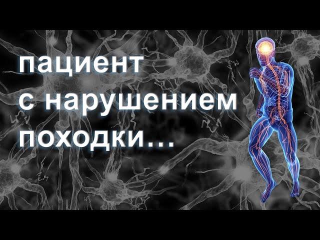 Клинический случай: 51-летняя пациентка с нарушением походки