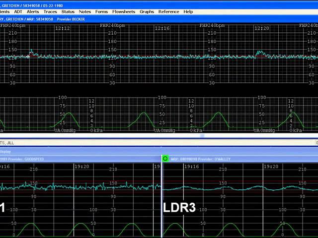 E Tools Demo : OBIX Perinatal Data System by Clinical Computer Systems INC. (CCSI)