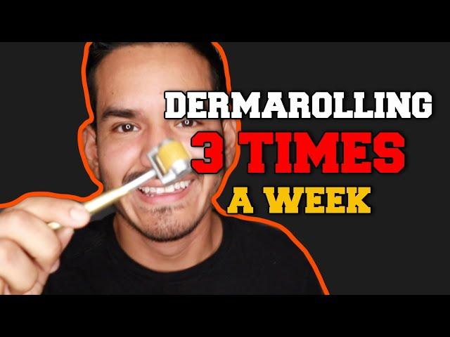 DERMAROLLER: FOR BEARD GROWTH