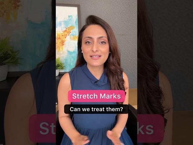 Stretch marks | Prevention & treatment | Dermatologist