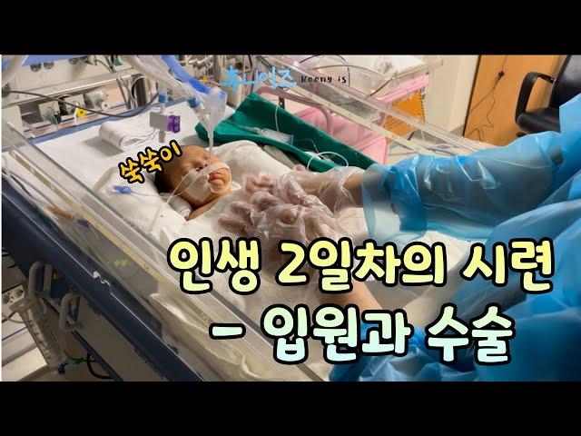 아빠로그 | 내가 대신 아팠으면… 삼성서울병원 신생아중환자실/밀폐항문/쇄항