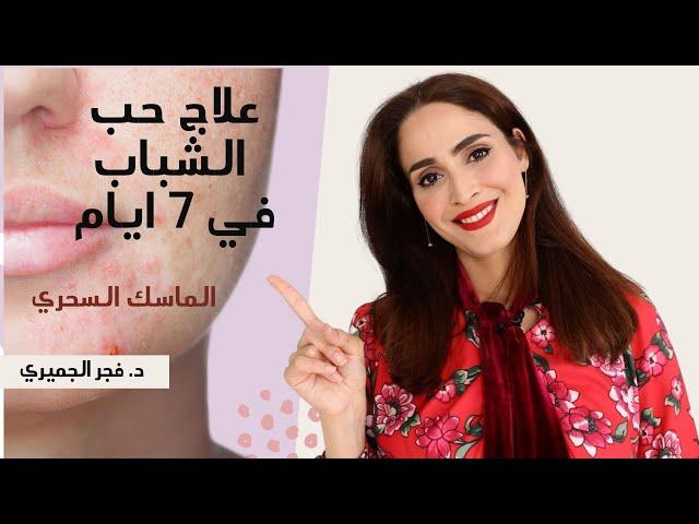 علاج حبوب الوجه في ٧ ايام | حب الشباب وعلاجه السريع