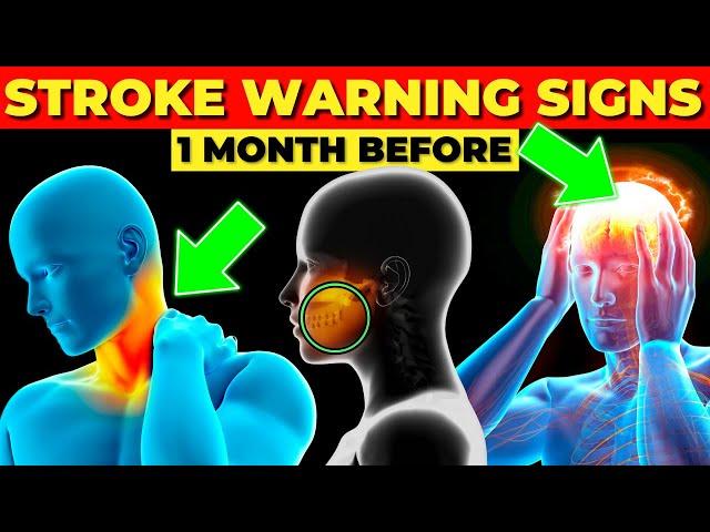 7 Stroke Symptoms 1 month before it happens (Detect it Quickly)