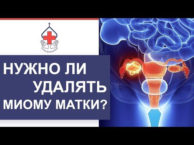  Что такое миома матки, и как ее лечить. Как лечить миому матки. 12+