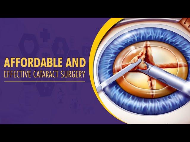 Centre for Sight | Affordable And Effective Cataract Surgery