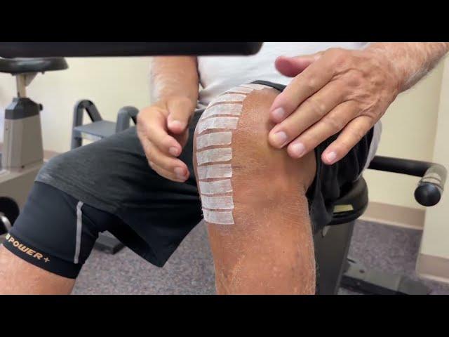 15-Days After a total knee replacement Day 1 of outpatient physical therapy. AMAZING!!! Part 1