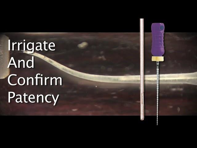 WaveOne® Instructional | Dentsply Sirona