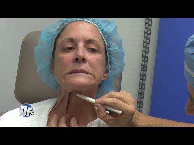 Watch Live Neck Lift Procedure!