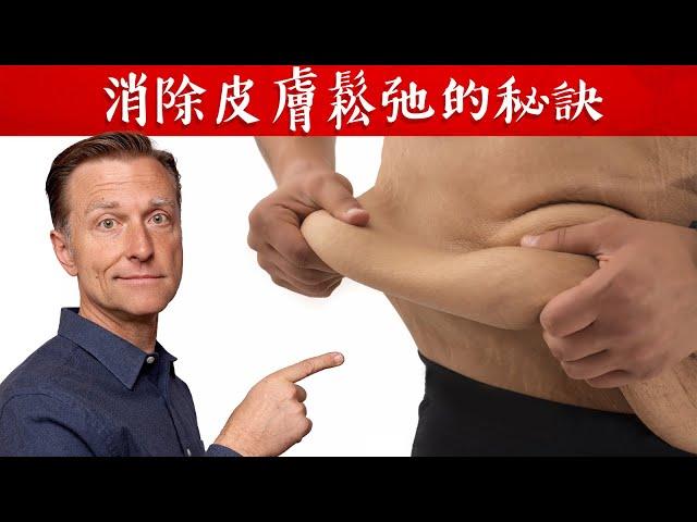 【皮膚】消除皮膚鬆弛的秘訣,自然療法,柏格醫生 Dr Berg