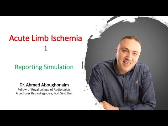 | Vascular | Acute LL ischemia | Emboli | Reporting Simulation |