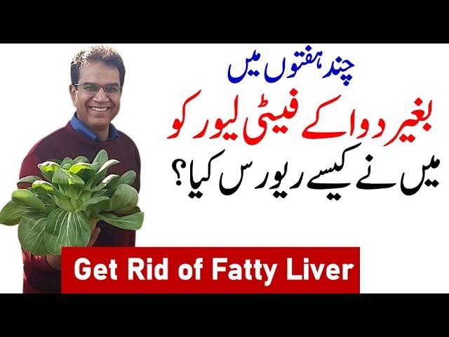 fatty liver symptoms | fatty liver treatment | Detoxify Fatty liver without medicine