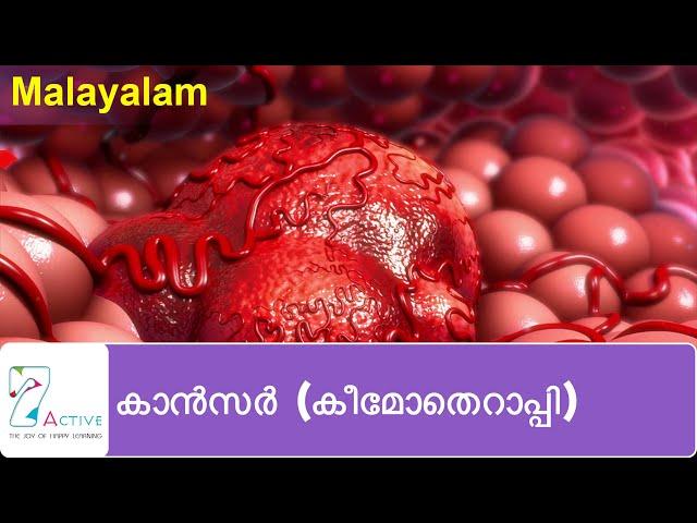 കാൻസർ (കീമോതെറാപ്പി) | Cancer (Chemotherapy) | Malayalam