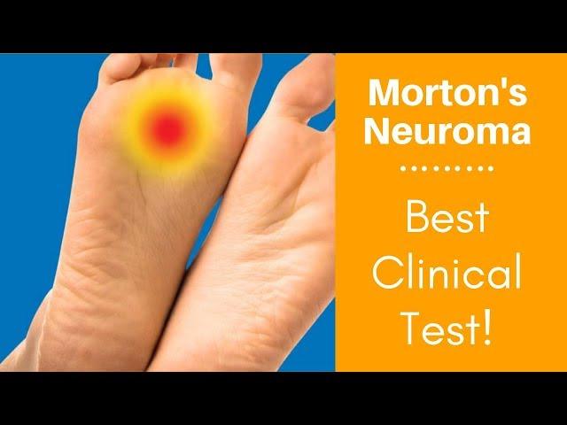 Morton's Neuroma: Best Clinical Test!