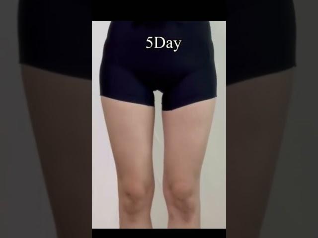 하루8분일주일허벅지안쪽살빼기하체다이어트