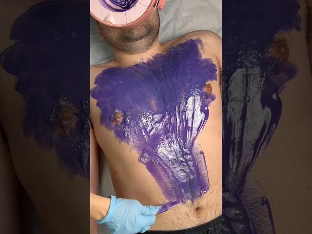 Crazy Chest Wax  #waxingathome #hairremoval #wax #waxkit #hardwax #chestwax