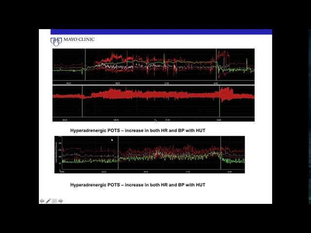 Sjögren Syndrome and the Autonomic Nervous System: When, How, What Now?