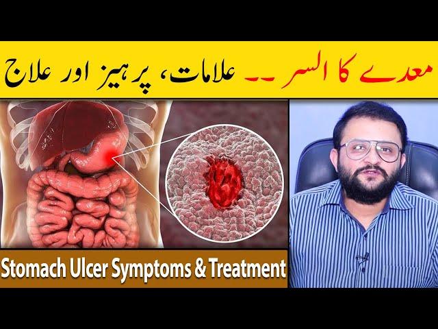 Stomach Ulcer Symptoms & Treatment - Stomach Ulcer Ka Ilaj - Maidey Ka Ulcer - Dr Raja Omer Fiaz