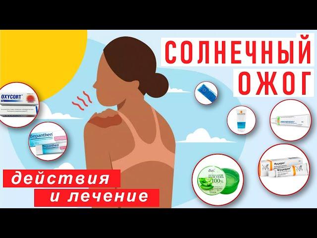 После солнечного ожога: лекарства и действия