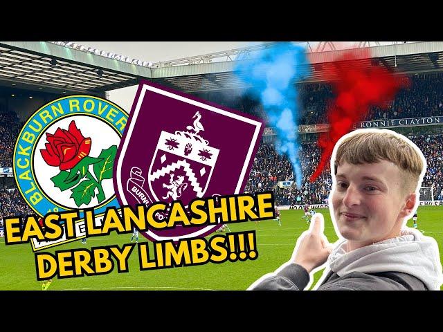 EAST LANCASHIRE DERBY LIMBS | BLACKBURN VS BURNLEY VLOG!!!