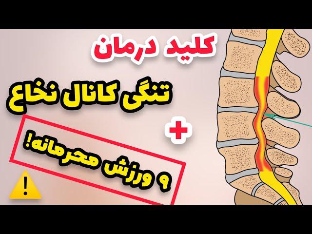 ورزش های ساده واسان برای تنگی کانال نخاع کمر وگردن در منزل | ۹ورزش ساده در منزل برای تنگی کانال نخاع