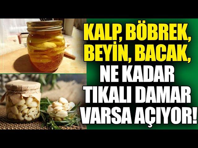 Kalp, Böbrek, Beyin, Bacak, Ne Kadar Tıkalı Damar varsa Açıyor!