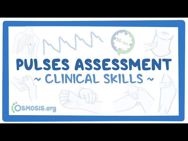 Clinical Skills: Pulses assessment