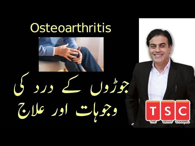 Osteoarthritis Treatment | Joron Ke Dard Ka Ilaj | its Treatment by Adeel mansoor Urdu|Hindi