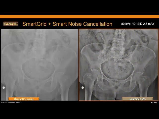 AI in Action in Radiology—Taking Imaging Process to New Heights