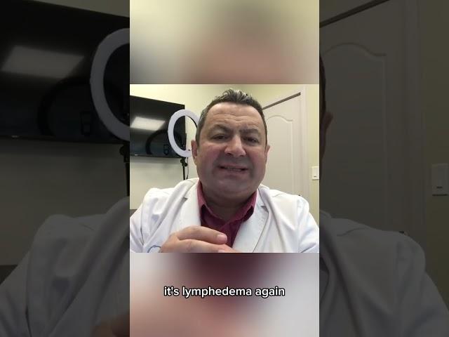 Test for Lymphedema and Lipedema -Dr. Boris Volshteyn