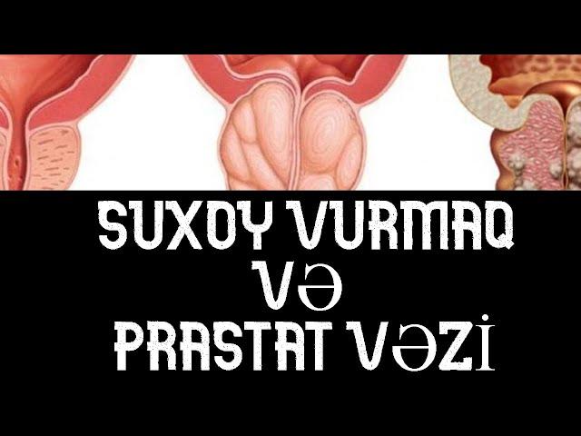 SUXOY vurmaq və PRASTAT Vəzi ( TƏSİRİ )