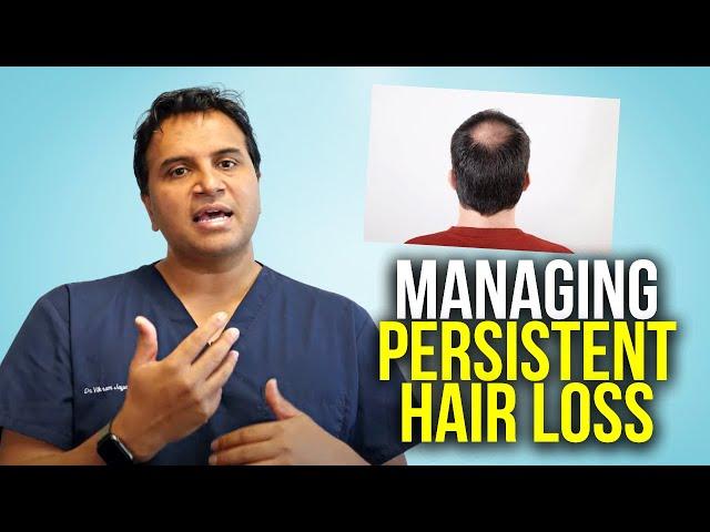 Managing Persistent Hair Loss Whilst On Finasteride and Dutasteride