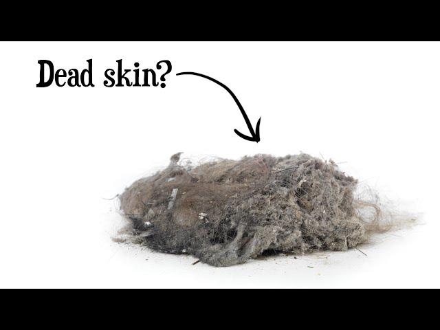 Is Dust Mostly Dead Skin?