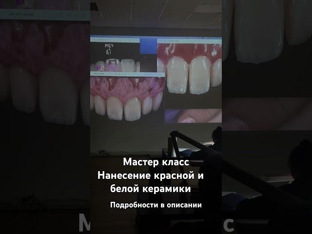 Курсы для зубного техника #зубнойтехникмосква https://butterfly-lab.ru/reg-kurs #курсы