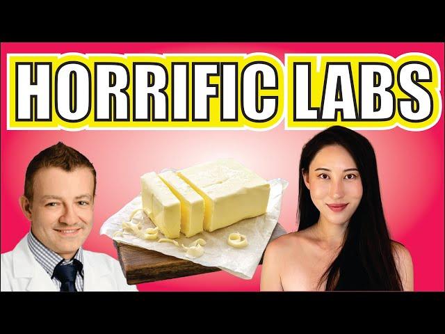 Cardiologist SHOCKED by Steak and Butter Gal's Cholesterol Results!