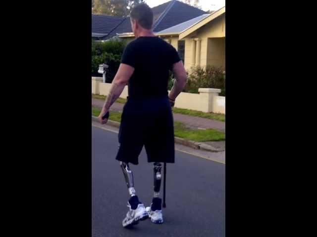 bilateral above knee amputee Darren walking with c-legs