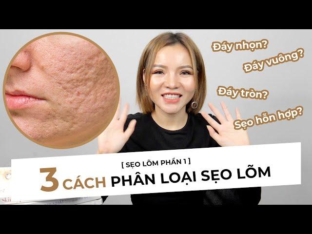 TRỊ SẸO RỖ [P1] - 3 CÁCH PHÂN LOẠI SẸO LÕM CHUYÊN SÂU