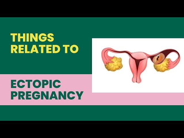 Ectopic pregnancy Key Points/ Easy to remember the points of ectopic pregnancy/ tubal rupture