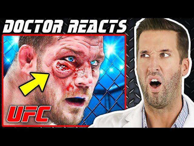 ER Doctor REACTS to Worst MMA Injuries in UFC History