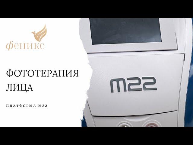 #Фототерапия на платформе #М22