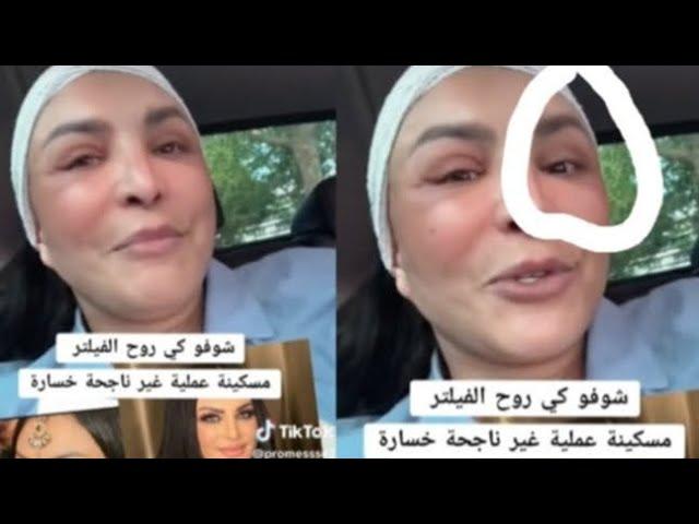 مسكينة ربيكا عملية غير ناحجة خسارة ⁉️