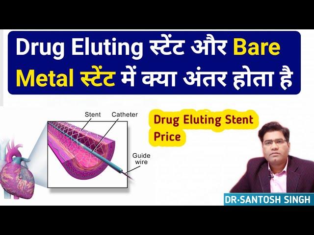 What are The Differences Between Drug Eluting Stent and Bare Metal Stent