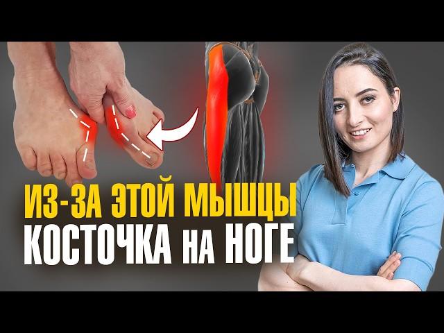 Косточка на большом пальце ноги, вальгусные стопы, заваленные колени и всё из-за ЭТОЙ мышцы