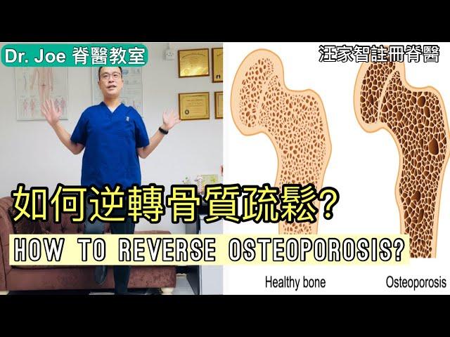 如何逆轉骨質疏鬆？ Dr Joe 教大家兩種方法: 運動及營養[Eng Subtitles] How to Reverse Osteoporosis in 2 Steps.