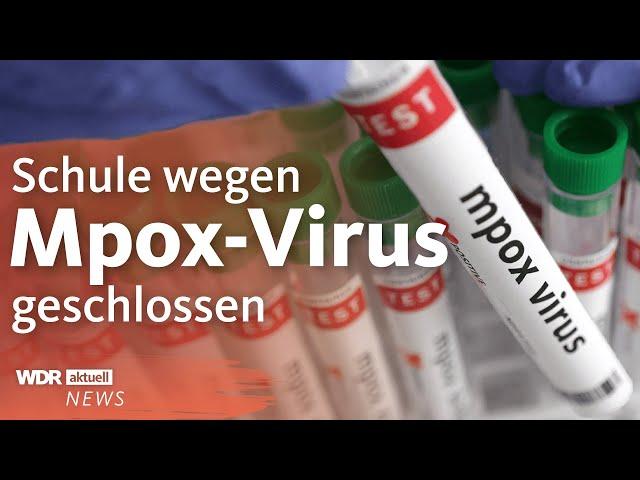 Mpox-Virus in NRW: Schule in Rösrath geschlossen | WDR Aktuelle Stunde