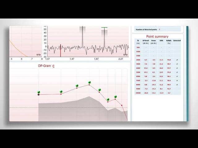 New IA OAE Suite - Interacoustics